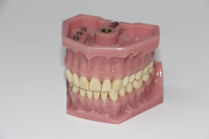 How to get dentures