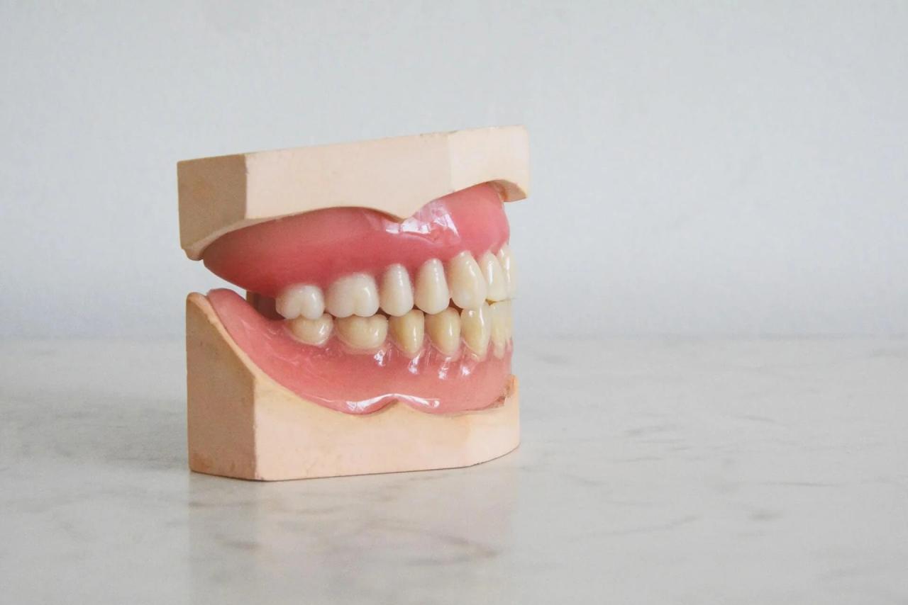 How long does it take to reverse gingivitis