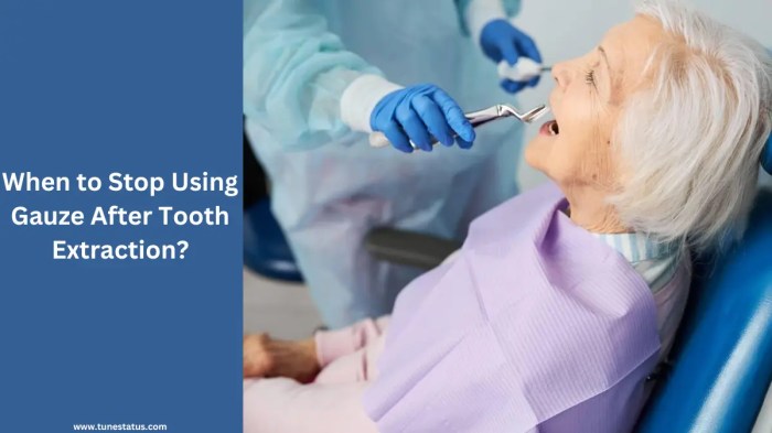 How long to wear gauze after tooth extraction