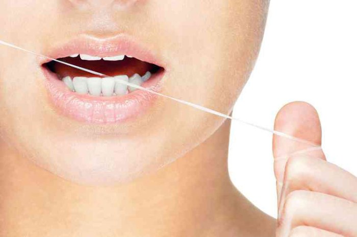 How to floss with a permanent retainer
