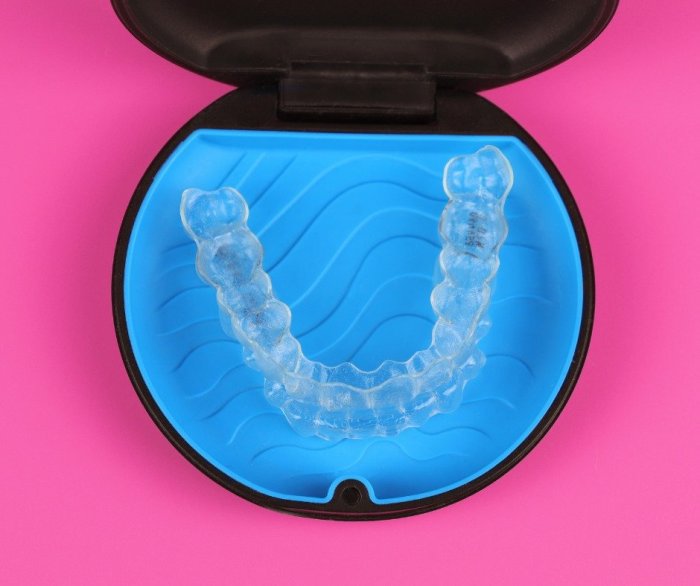 How long does it take to get invisalign