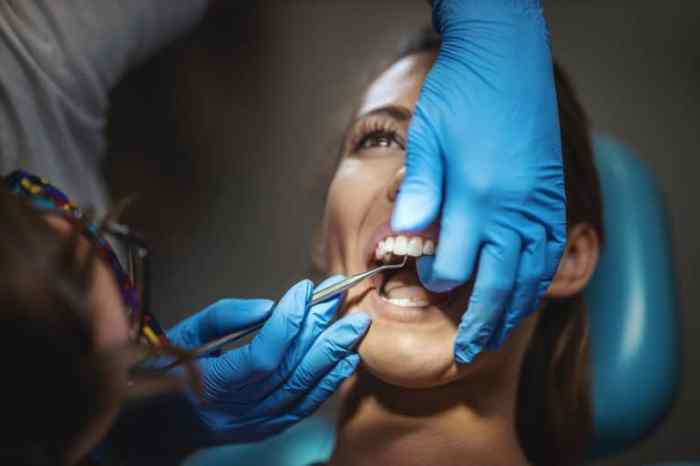 How much does it cost to fix a chipped crown