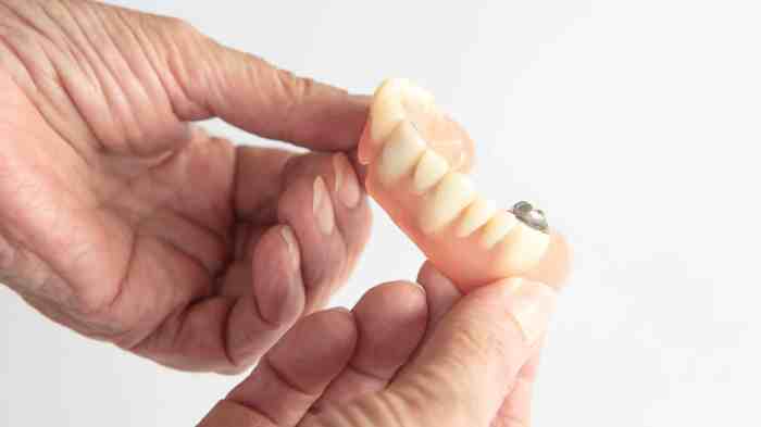 How to get dentures