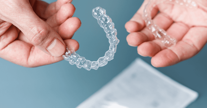 How long does it take to get invisalign
